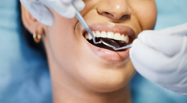Best Emergency Tooth Extraction in Canton Valley, CT